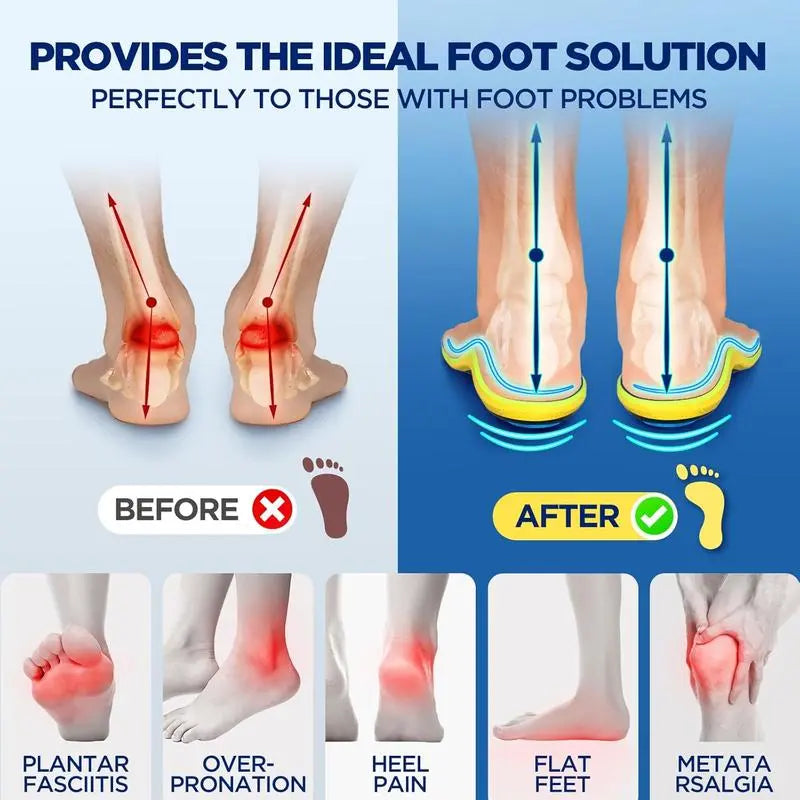 AQA™ Magnetic Acupressure Insoles for All-Day Foot Comfort
