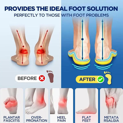 AQA™ Magnetic Acupressure Insoles for All-Day Foot Comfort